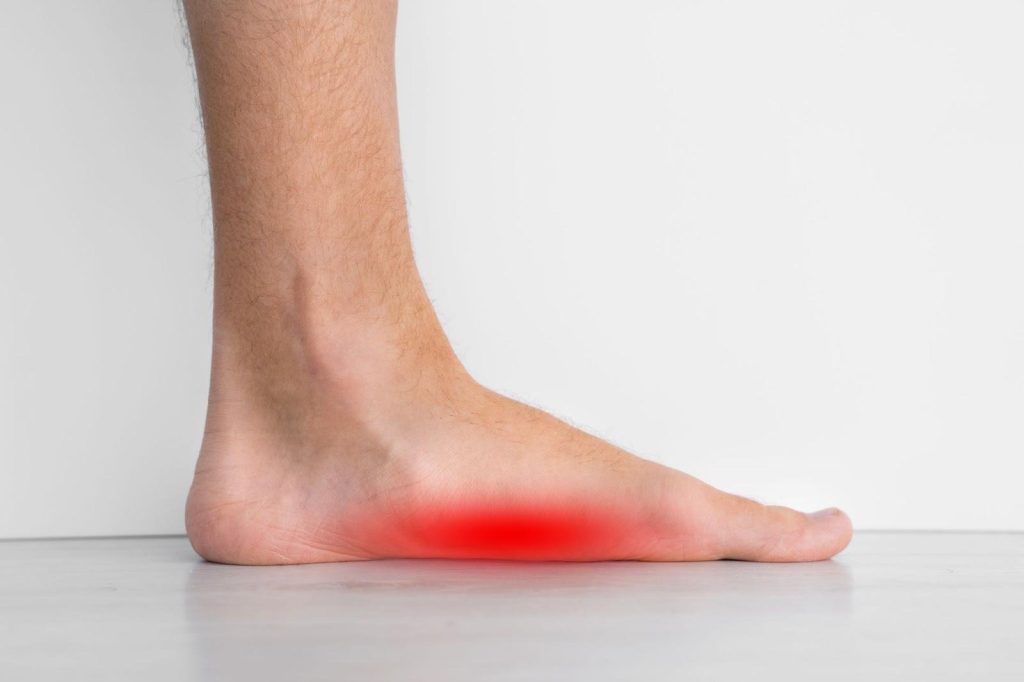 Symptoms of Flat Feet Singapore